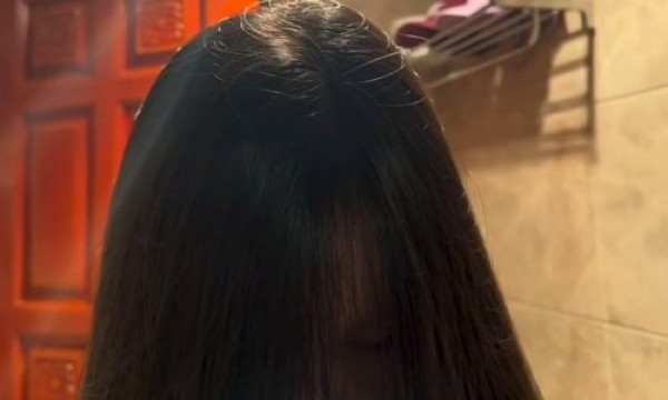 去除头皮屑用什么洗发水好，头皮屑多头皮痒用什么洗发水好？