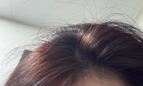 什么洗发水去屑止痒控油又蓬松，哪一款洗发水去屑止痒效果好？