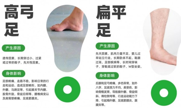 2026年扁平足矫正TOP5方法大揭秘，哪种才最靠谱？